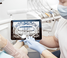 Radiografia Digital - NEV Endodontia