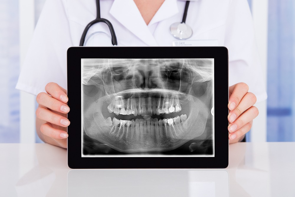 Checkup Odontológico Digital