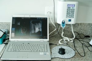 Radiografia Digital Nev Endodontia- Endodontia Automatizada